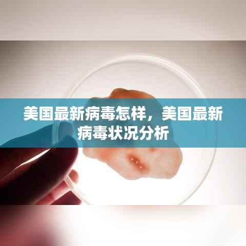 美国最新病毒状况深度分析,现状与趋势探讨