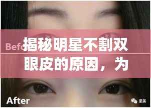 揭秘明星不割双眼皮的原因,为何选择自然美?